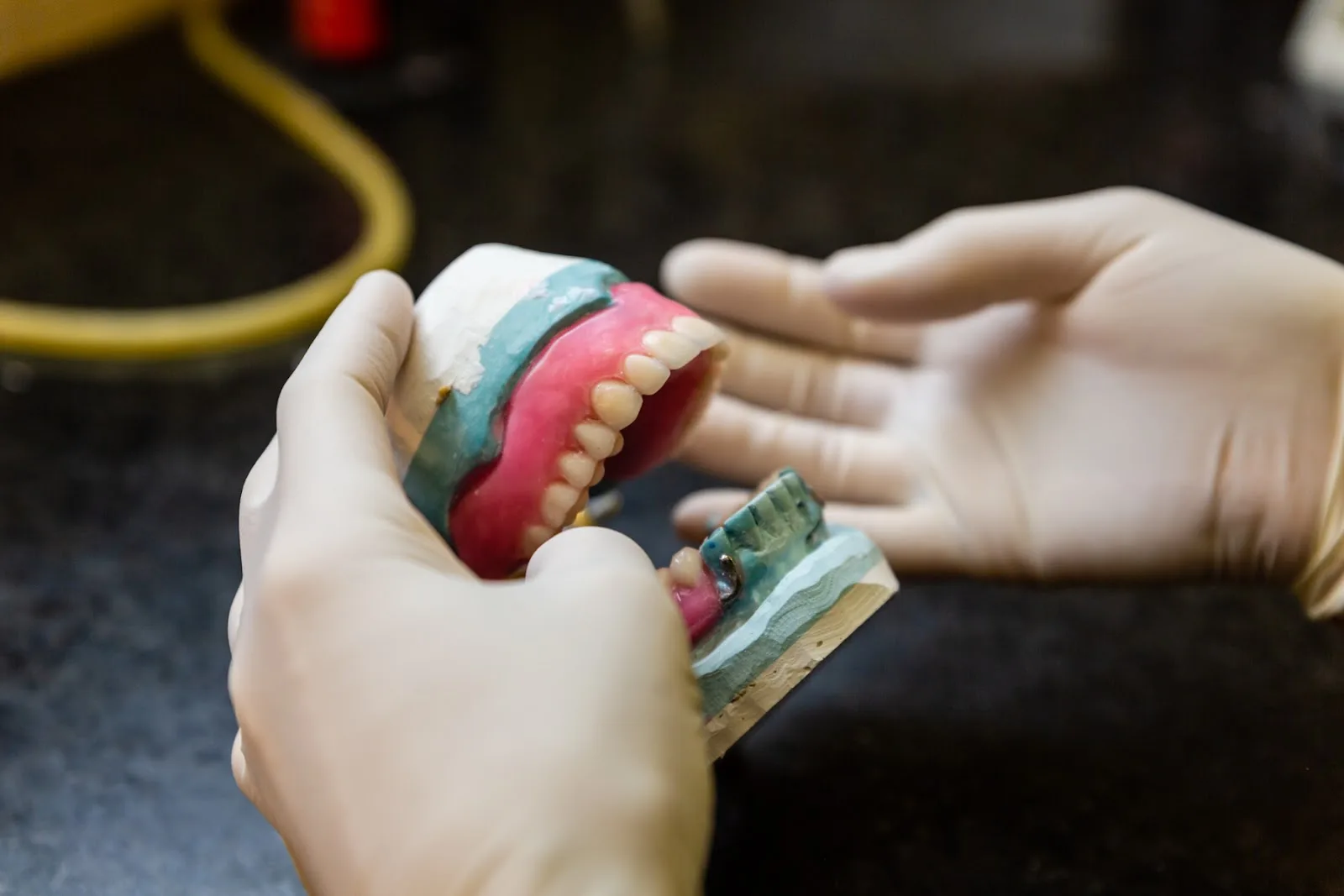 Custom dental restorations being crafted in the in-house lab